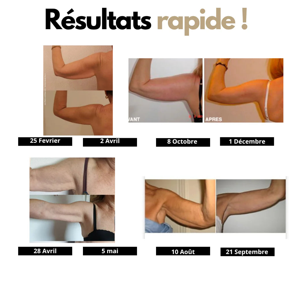 Manchons Sculptants Ceralia®